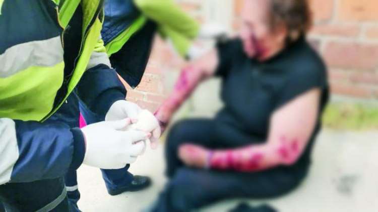 La víctima había perdido mucha sangre  se estima que al menos 10 perros ocasionaron las heridas.