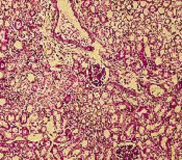 Patología neonatal. Aspecto histológico característico del riñón de un cachorro infectado por el herpesvirus canino (inclusiones herpéticas). 